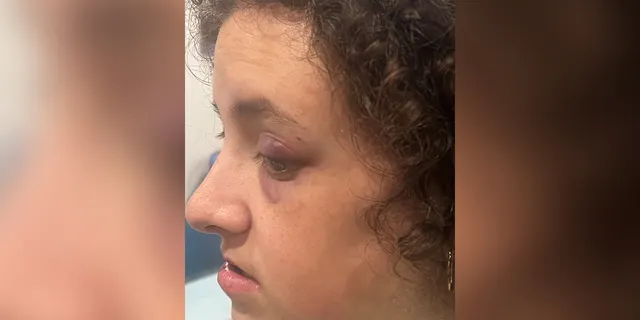 Maryland Special Needs Woman Attacked on Rockville Bus